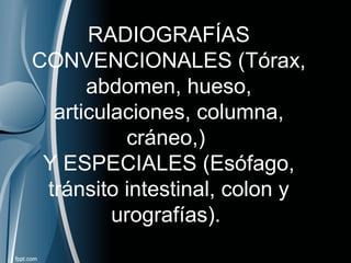 RADIOGRAFÍAS
CONVENCIONALES (Tórax,
abdomen, hueso,
articulaciones, columna,
cráneo,)
Y ESPECIALES (Esófago,
tránsito intestinal, colon y
urografías).
 