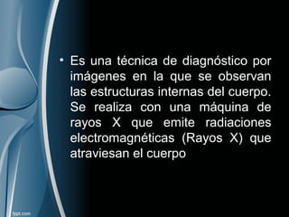 • Es una técnica de diagnóstico por
imágenes en la que se observan
las estructuras internas del cuerpo.
Se realiza con una máquina de
rayos X que emite radiaciones
electromagnéticas (Rayos X) que
atraviesan el cuerpo
 