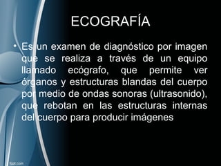 ECOGRAFÍA
• Es un examen de diagnóstico por imagen
que se realiza a través de un equipo
llamado ecógrafo, que permite ver
órganos y estructuras blandas del cuerpo
por medio de ondas sonoras (ultrasonido),
que rebotan en las estructuras internas
del cuerpo para producir imágenes
 