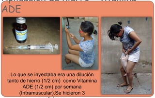 Aplicación de hierro + vitamina
ADE
Lo que se inyectaba era una dilución
tanto de hierro (1/2 cm) como Vitamina
ADE (1/2 cm) por semana
(Intramuscular).Se hicieron 3
 