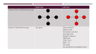 Right Eye Left Eye
Distant Direct Ophthalmoscopy
Indirect Ophthalmoscopy No glow Glow present
Media clear
Vertically oval disc
Average size
Margins distinct
NRR pink
CDR- 0.4:1
AVR- 2:3
FR sharp
No peripheral treatable lesion
 