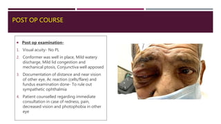 POST OP COURSE
 Post op examination-
1. Visual acuity- No PL
2. Conformer was well in place, Mild watery
discharge, Mild lid congestion and
mechanical ptosis, Conjunctiva well apposed
3. Documentation of distance and near vision
of other eye, Ac reaction (cells/flare) and
fundus examination done- To rule out
sympathetic ophthalmia
4. Patient counselled regarding immediate
consultation in case of redness, pain,
decreased vision and photophobia in other
eye
 