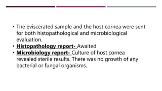 • The eviscerated sample and the host cornea were sent
for both histopathological and microbiological
evaluation.
• Histopathology report- Awaited
• Microbiology report- Culture of host cornea
revealed sterile results. There was no growth of any
bacterial or fungal organisms.
 