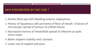 WHY EVISCERATION IN THIS CASE ?
1. Painful blind eye with bleeding anterior staphyloma
2. History of Squamous cell carcinoma of floor of mouth- Chances of
microscopic spread of tumour to orbital tissues
3. Decreased chances of intraorbital spread of infection as optic
nerve intact
4. Better implant mobility and cosmesis
5. Lower risk of implant extrusion
 