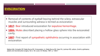 EVISCERATION
 Removal of contents of eyeball leaving behind the sclera, extraocular
muscles and surrounding adnexa is termed as evisceration
 1817- Bear introduced evisceration for expulsive hemorrhage.
 1884- Mules described placing a hollow glass sphere into the eviscerated
cavity.
 1887- First report of sympathetic ophthalmia occurring in association with
evisceration.
Meltzer MA, Schaefer DP, Della Rocca RC. Evisceration. In: Della Rocca RC, Nesi FA, Lishman RD, editors. Smith’s ophthalmic
plastic and reconstructive surgery. Vol. 2. St. Louis: CV Mosby; 1987. p. 1300-7
 