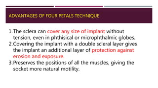 ADVANTAGES OF FOUR PETALS TECHNIQUE
1.The sclera can cover any size of implant without
tension, even in phthisical or microphthalmic globes.
2.Covering the implant with a double scleral layer gives
the implant an additional layer of protection against
erosion and exposure.
3.Preserves the positions of all the muscles, giving the
socket more natural motility.
 