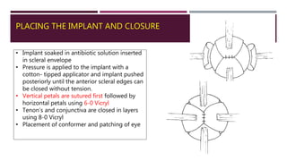 PLACING THE IMPLANT AND CLOSURE
• Implant soaked in antibiotic solution inserted
in scleral envelope
• Pressure is applied to the implant with a
cotton- tipped applicator and implant pushed
posteriorly until the anterior scleral edges can
be closed without tension.
• Vertical petals are sutured first followed by
horizontal petals using 6-0 Vicryl
• Tenon’s and conjunctiva are closed in layers
using 8-0 Vicryl
• Placement of conformer and patching of eye
 