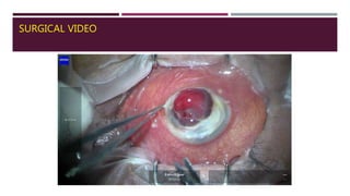 SURGICAL VIDEO
 