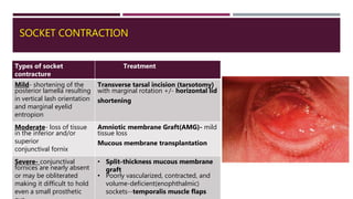 SOCKET CONTRACTION
Types of socket
contracture
Treatment
Mild- shortening of the
posterior lamella resulting
in vertical lash orientation
and marginal eyelid
entropion
Transverse tarsal incision (tarsotomy)
with marginal rotation +/- horizontal lid
shortening
Moderate- loss of tissue
in the inferior and/or
superior
conjunctival fornix
Amniotic membrane Graft(AMG)- mild
tissue loss
Mucous membrane transplantation
Severe- conjunctival
fornices are nearly absent
or may be obliterated
making it difficult to hold
even a small prosthetic
• Split-thickness mucous membrane
graft
• Poorly vascularized, contracted, and
volume-deficient(enophthalmic)
sockets--temporalis muscle flaps
 