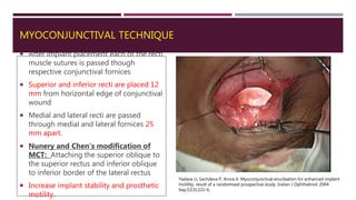 MYOCONJUNCTIVAL TECHNIQUE
 After implant placement each of the recti
muscle sutures is passed though
respective conjunctival fornices
 Superior and inferior recti are placed 12
mm from horizontal edge of conjunctival
wound
 Medial and lateral recti are passed
through medial and lateral fornices 25
mm apart.
 Nunery and Chen's modification of
MCT: Attaching the superior oblique to
the superior rectus and inferior oblique
to inferior border of the lateral rectus
 Increase implant stability and prosthetic
motility.
Yadava U, Sachdeva P, Arora V. Myoconjunctival enucleation for enhanced implant
motility. result of a randomised prospective study. Indian J Ophthalmol. 2004
Sep;52(3):221-6.
 