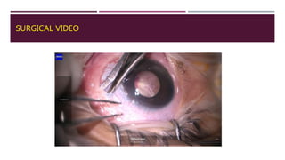 SURGICAL VIDEO
 