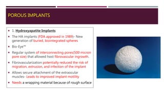 POROUS IMPLANTS
 1. Hydroxyapatite Implants
 The HA implants (FDA approved in 1989)- New
generation of buried, biointegrated spheres
 Bio-Eye™
 Regular system of interconnecting pores(500 micron
pore size) that allowed host fibrovascular ingrowth.
 Fibrovascularization potentially reduced the risk of
migration, extrusion, and infection of the implant
 Allows secure attachment of the extraocular
muscles- Leads to improved implant motility
 Needs a wrapping material because of rough surface
 