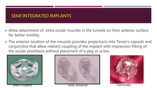 SEMI INTEGRATED IMPLANTS
 Allow attachment of extra ocular muscles in the tunnels on their anterior surface
for better motility.
 The anterior location of the mounds provides projections into Tenon’s capsule and
conjunctiva that allow indirect coupling of the implant with impression fitting of
the ocular prosthesis without placement of a peg or screw.
Allen's implant Iowa, Universal Castroviejo
 