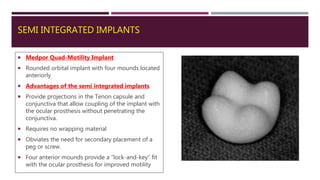 SEMI INTEGRATED IMPLANTS
 Medpor Quad-Motility Implant
 Rounded orbital implant with four mounds located
anteriorly
 Advantages of the semi integrated implants
 Provide projections in the Tenon capsule and
conjunctiva that allow coupling of the implant with
the ocular prosthesis without penetrating the
conjunctiva.
 Requires no wrapping material
 Obviates the need for secondary placement of a
peg or screw.
 Four anterior mounds provide a “lock-and-key” fit
with the ocular prosthesis for improved motility
 