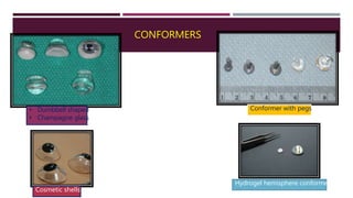 CONFORMERS
• Dumbbell shaped
• Champagne glass
Hydrogel hemisphere conformer
Conformer with pegs
Cosmetic shells
 