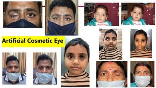 Artificial Cosmetic Eye
 