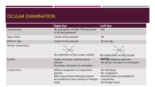 OCULAR EXAMINATION
Right Eye Left Eye
Visual acuity No perception of light, PR inaccurate
in all the quadrants
6/6
Near Vision Could not be assesed N6
IOP(mm hg) Could not be assesed 14 mm Hg
Ocular movements
No restriction of any ocular motility
Eyelids Upper and lower eyelids edema
present
No ptosis, ectropion on entropion
Normal palpebral aperture
No ptosis, ectropion on entropion
Conjunctiva Diffuse congestion of conjunctiva
present
Mild conjunctival chemosis present
No evidence of any scarring or foreign
body
No discharge
No congestion
Normal bulbar and palpebral
conjunctiva
No foreign body
No restriction of any ocular
motility
 