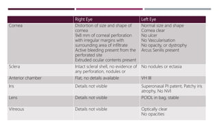 Right Eye Left Eye
Cornea Distortion of size and shape of
cornea
9x8 mm of corneal perforation
with irregular margins with
surrounding area of infiltrate
Active bleeding present from the
perforated site
Extruded ocular contents present
Normal size and shape
Cornea clear
No ulcer
No Vascularisation
No opacity, or dystrophy
Arcus Senilis present
Sclera Intact scleral shell, no evidence of
any perforation, nodules or
No nodules or ectasia
Anterior chamber Flat, no details available VH III
Iris Details not visible Superonasal PI patent, Patchy iris
atrophy, No NVI
Lens Details not visible PCIOL in bag, stable
Vitreous Details not visible Optically clear
No opacities
 
