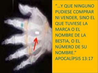 “…Y QUE NINGUNO PUDIESE COMPRAR NI VENDER, SINO EL QUE TUVIESE LA MARCA O EL NOMBRE DE LA BESTIA, O EL NÚMERO DE SU NOMBRE.”APOCALÍPSIS 13:17