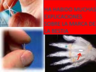 HA HABIDO MUCHAS EXPLICACIONES SOBRE LA MARCA DE LA BESTIA