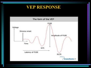 VEP RESPONSE
 