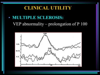 CLINICAL UTILITY
• MULTIPLE SCLEROSIS:
  VEP abnormality – prolongation of P 100
 