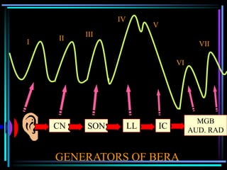 IV
                         V
         III
    II
I                                        VII

                                  VI




                                         MGB
    CN   SON        LL       IC        AUD. RAD


    GENERATORS OF BERA
 