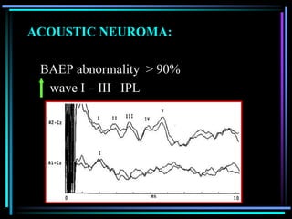 ACOUSTIC NEUROMA:

 BAEP abnormality > 90%
  wave I – III IPL
 