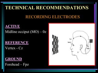 TECHNICAL RECOMMENDATIONS
            RECORDING ELECTRODES

ACTIVE
Midline occiput (MO) – 0z

REFERENCE
Vertex - Cz

GROUND
Forehead – Fpz
 