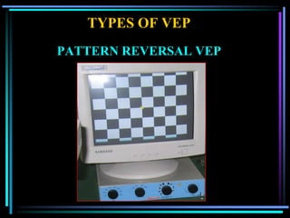 TYPES OF VEP
PATTERN REVERSAL VEP
 