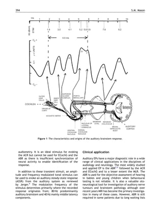 audiometry. It is an ideal stimulus for evoking
the ACR but cannot be used for ECochG and the
ABR as there is insufﬁcient synchronization of
neural activity to enable identiﬁcation of the
response.
In addition to these transient stimuli, an ampli-
tude and frequency modulated tonal stimulus can
be used to evoke an auditory steady-state response
(ASSR) from the auditory system as reviewed
by Jerger.4
The modulation frequency of the
stimulus determines primarily where the recorded
response originates from; 80 Hz predominantly
auditory brainstem and 40 Hz mainly middle latency
components.
Clinical application
Auditory EPs have a major diagnostic role in a wide
range of clinical applications in the disciplines of
audiology and neurology. The most widely studied
and applied EP is the ABR3,5
followed by the ACR
and ECochG and to a lesser extent the MLR. The
ABR is used for the objective assessment of hearing
in babies and young children when behavioural
testing is not reliable. It is also a valuable oto-
neurological tool for investigation of auditory nerve
tumours and brainstem pathology although over
recent years MRI has become the primary investiga-
tion in many of these cases. However, ABR is still
required in some patients due to long waiting lists
ARTICLE IN PRESS
ms
60dBnHL
STIM
1.9 3.0 4.1 5.2 5.8 5.9 7.6 9.2
1 2 3 4 5 6 7 8 9 10
CZ
+
CZ −
4.0 ms
vUNITS
COCHLEA
AUDITORY
CORTEX
MEDIAL
GENICULATE
BODY
INFERIOR
COLLICULUS
MIDBRAIN
LEVELNUCLEUS OF
LATERAL
LEMNISCUS
DORSAL
COCHLEAR
NUCLEUS
VENTRAL
COCHLEAR
NUCLEUS
ACOUSTIC NERVE
ORGAN OF
CORTI
OUTER
HAIR
CELLS
INNER
HAIR
CELL
SUPERIOR
OLIVARY
COMPLEX
PONTO-
MEDULLARY
I
II
III
IV
VI
VII
V
0.1
Figure 1 The characteristics and origins of the auditory brainstem response.
S.M. Mason394
 