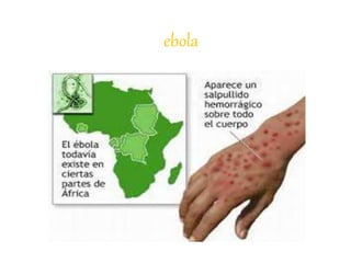 ebola
 