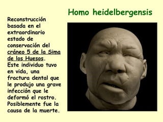 Homo heidelbergensis
Reconstrucción
basada en el
extraordinario
estado de
conservación del
cráneo 5 de la Sima
de los Huesos.
Este individuo tuvo
en vida, una
fractura dental que
le produjo una grave
infección que le
deformó el rostro.
Posiblemente fue la
causa de la muerte.
 