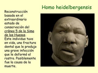 Homo heidelbergensis Reconstrucción basada en el extraordinario estado de conservación del  cráneo 5 de la Sima de los Huesos .  Este individuo tuvo en vida, una fractura dental que le produjo una grave infección que le deformó el rostro. Posiblemente fue la causa de la muerte. 