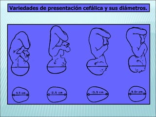 Variedades de presentación cefálica y sus diámetros. 