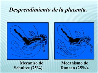 Desprendimiento de la placenta. Mecaniso de Schultze (75%). Mecanismo de Duncan (25%). 