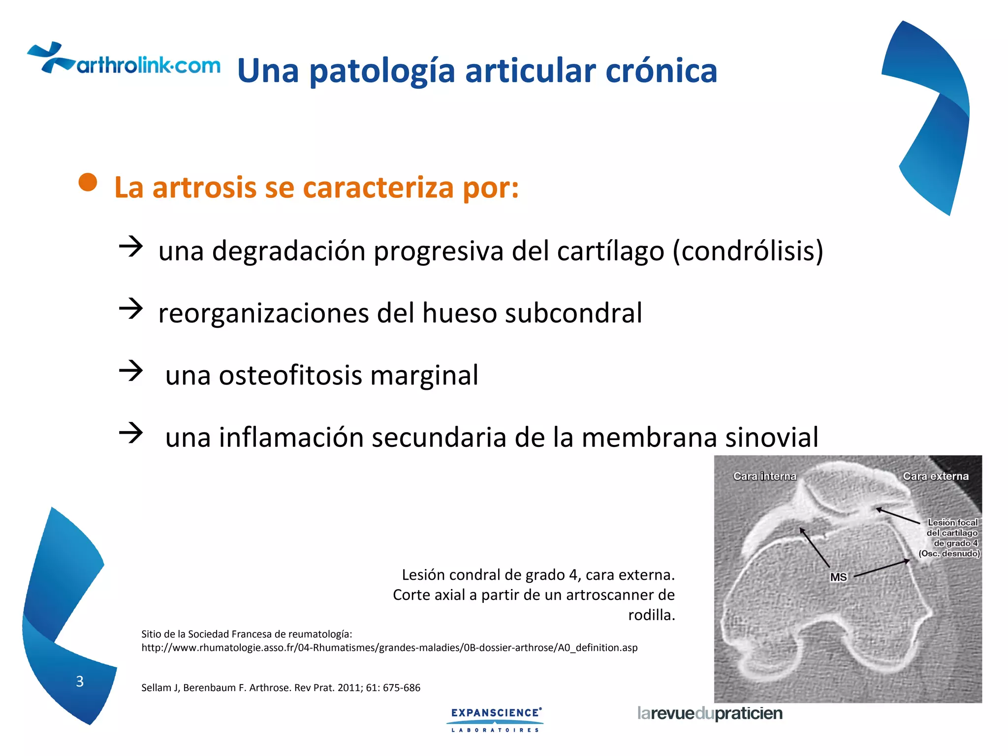 Evolución de la artrosis | PPT