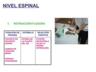 NIVEL ESPINAL RETRACCIÓN FLEXORA POSICIÓN DE PRUEBA ESTÍMULO REACCIÓN POSITIVA PACIENTE EN DECÚBITO SUPINO CABEZA EN POSICIÓN MEDIA PIERNAS EXTENDIDAS ESTIMULAR LA PLANTA DEL PIE FLEXIÓN INCONTROLADA DE LA PIERNA ESTIMULADA 