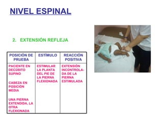 NIVEL ESPINAL 2.  EXTENSIÓN REFLEJA POSICIÓN DE PRUEBA ESTÍMULO REACCIÓN POSITIVA PACIENTE EN DECÚBITO SUPINO CABEZA EN POSICIÓN MEDIA UNA PIERNA  EXTENDIDA, LA OTRA FLEXIONADA ESTIMULAR LA PLANTA DEL PIE DE LA PIERNA FLEXIONADA EXTENSIÓN INCONTROLA-DA DE LA PIERNA ESTIMULADA 