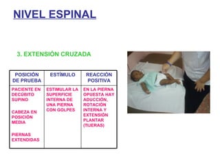 NIVEL ESPINAL 3. EXTENSIÓN CRUZADA POSICIÓN DE PRUEBA ESTÍMULO REACCIÓN POSITIVA PACIENTE EN DECÚBITO SUPINO CABEZA EN POSICIÓN MEDIA PIERNAS EXTENDIDAS ESTIMULAR LA SUPERFICIE INTERNA DE UNA PIERNA CON GOLPES EN LA PIERNA OPUESTA HAY ADUCCIÓN, ROTACIÓN INTERNA Y EXTENSIÓN PLANTAR (TIJERAS) 
