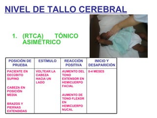 NIVEL DE TALLO CEREBRAL (RTCA) TÓNICO ASIMÉTRICO POSICIÓN DE PRUEBA ESTÍMULO REACCIÓN POSITIVA INICIO Y DESAPARICIÓN PACIENTE EN DECÚBITO SUPINO CABEZA EN POSICIÓN MEDIA BRAZOS Y PIERNAS EXTENDIDAS VOLTEAR LA CABEZA HACIA UN LADO AUMENTO DEL TONO EXTENSOR EN HEMICUERPO FACIAL AUMENTO DE TONO FLEXOR EN HEMICUERPO NUCAL 0-4 MESES 