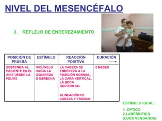 NIVEL DEL MESENCÉFALO 3.  REFLEJO DE ENDEREZAMIENTO ESTIMULO IGUAL: 1. OPTICO 2.LABERINTICO (OJOS VENDADOS) POSICIÓN DE PRUEBA ESTÍMULO REACCIÓN POSITIVA DURACIÓN SOSTENGA AL PACIENTE EN EL AIRE DESDE LA PELVIS INCLÍNELO HACIA LA IZQUIERDA O DERECHA LA CABEZA SE ENDEREZA A LA POSICIÓN NORMAL, LA CARA VERTICAL, LA BOCA HORIZONTAL ALINEACIÓN DE CABEZA Y TRONCO 6 MESES 