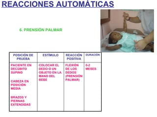 6. PRENSIÓN PALMAR REACCIONES AUTOMÁTICAS POSICIÓN DE PRUEBA ESTÍMULO REACCIÓN POSITIVA DURACIÓN PACIENTE EN DECÚBITO SUPINO CABEZA EN POSICIÓN MEDIA BRAZOS Y PIERNAS EXTENDIDAS COLOCAR EL DEDO O UN OBJETO EN LA MANO DEL BEBE FLEXIÓN DE LOS DEDOS (PRENSIÓN PALMAR) 0-2 MESES 