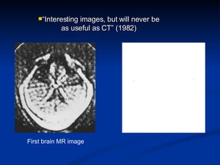 First brain MR image “ Interesting images, but will never be as useful as CT” (1982) 