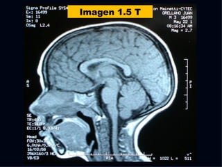 Imagen 1.5 T 