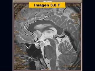 Imagen 3.0 T 