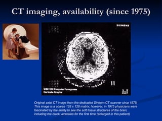 CT imaging, availability (since 1975) Original axial CT image from the dedicated Siretom CT scanner circa 1975.  This image is a coarse 128 x 128 matrix; however, in 1975 physicians were fascinated by the ability to see the soft tissue structures of the brain,  including the black ventricles for the first time (enlarged in this patient) 