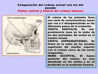 Comparación del cráneo actual con los del
                   pasado
Vistas central y lateral del cráneo humano

                   El cráneo de los primates tiene
                   una serie de características óseas
                   que van a ir desapareciendo en los
                   diferentes pasos de la evolución.
                   CRISTA     SAGITALIS.    Es    una 
                   prominencia ósea en la unión de
                   los dos parietales. No existe en el
                   hombre actual.
                   CRISTA SUPRAMASTOIDEA. Se
                   forma en la unión de las arcadas
                   superiores del maxilar superior
                   con el cráneo cerca de las zonas
                   temporales.
                   MOÑO     OCCIPITAL.     El   hueso
                   posterior del cráneo, es muy
                   abombado en los simios y se va
                   perdiendo en la evolución humana
 