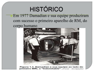 Em 1977 Damadian e sua equipe produziram
com sucesso o primeiro aparelho de RM, do
corpo humano
 