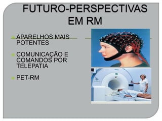 APARELHOS MAIS
POTENTES
 COMUNICAÇÃO E
COMANDOS POR
TELEPATIA
 PET-RM
 
